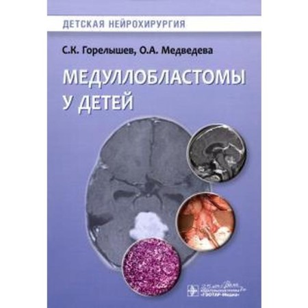 Medulloblastoma in children. Goreleyshev S., Medvedev
