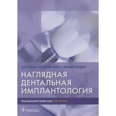 Visual dental implantology. Male Zh.