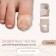 Protective covers for correction of ingrown nails, steam, 2.8 x 2 cm, the color is transparent
