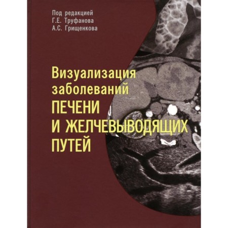 Visualization of liver diseases and biliary tract. Tutorial. Bagnenko S.S., Efimtsev A. Yu., Grishchenkov A.S.
