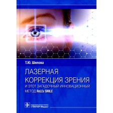 Лазерная коррекция зрения и этот загадочный инновационный метод ReLEx SMILE. Шилова Т.Ю.