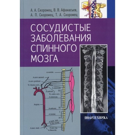 Vascular diseases of the spinal cord. Skorometets A.A.