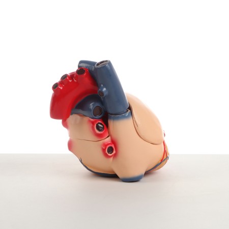 Matca "Human Heart" 26*18*22cm-2