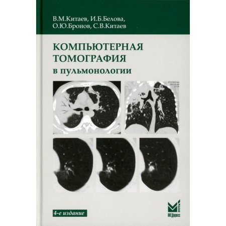 Computed tomography in pulmonology. 4th edition. Kitaev V.M., Belova I.B., Bronov O.Yu.