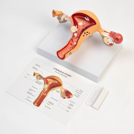 Matcage "Organs of the uterus, pathology" 24*12*20cm-3