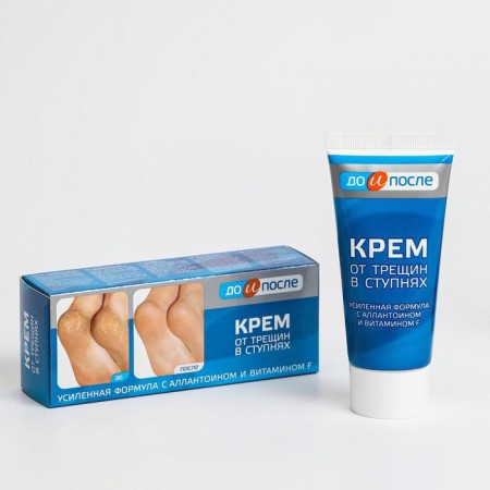 Legs cream from cracks in the feet, "before and after", 50 ml-1