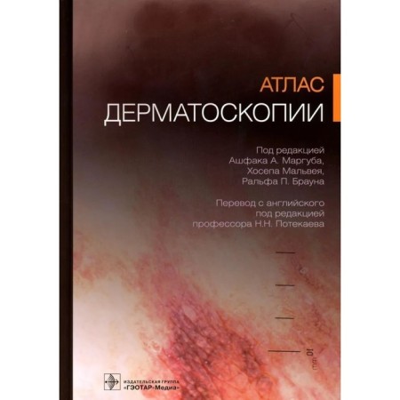 Atlas of dermatoscopy. Ashfaka A.