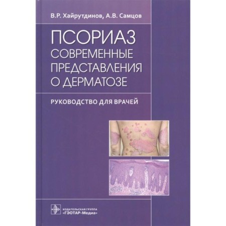 Psoriasis. Modern ideas about dermatosis. Khayutdinov V., Marts A.