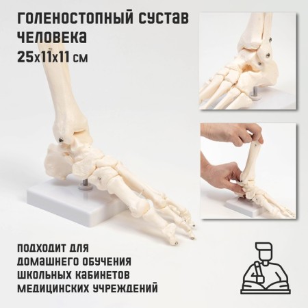 The Ikolnostopic joint layout is 25*11*11cm