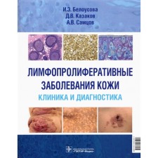 Лимфопролиферативные заболевания кожи. Клиника и диагностика. Белоусова И. и другие