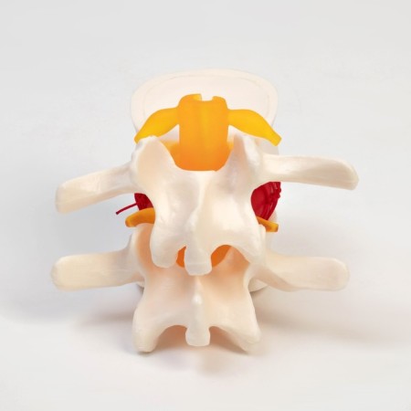 Lock "Intervertebral disc" 11*10*8cm-2