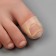Protective covers for correction of ingrown nails, steam, 2.8 x 2 cm, the color is transparent