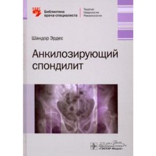 Ankylosing spondylitis. Erdem Sh.