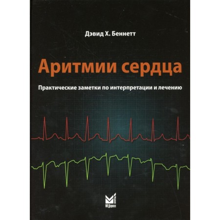 Аритмии сердца. Беннетт Д.Х.