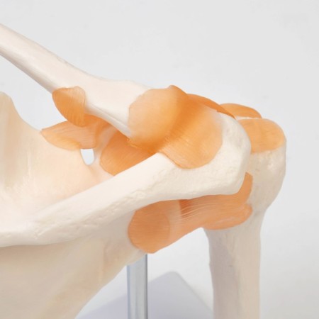 Mettle "shoulder joint" 23*15*15cm-4