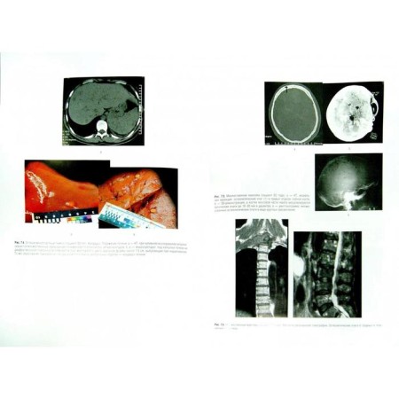 Hematology. Ed. Rukavitsyna O.A.-1