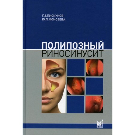 Polypozoic rhinosinusitis. 2nd edition, supplemented. Piskunov G.Z.