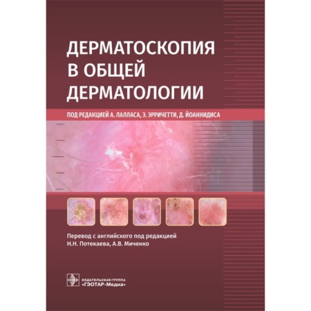 Dermatoscopy in general dermatology. Ed. Lallas A.