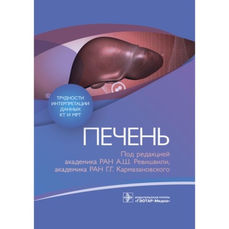 Difficulties in the interpretation of CT and MRI data: liver. Ed. Revishvili A.Sh., Karmazanovsky G.G.