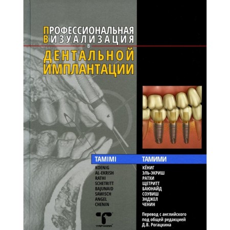 Professional visualization in dental implantation. Tamimi D.F.