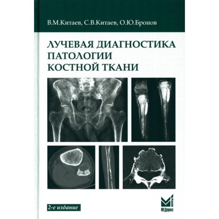 Radiation diagnosis of bone pathology. 2nd edition. Kitaev V.M., Kitaev S.V., Bronov O.Yu.