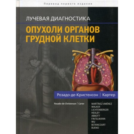 Radiation diagnostics. Breast organs tumors. Rosado de Crinson M.L., Carter B.V.