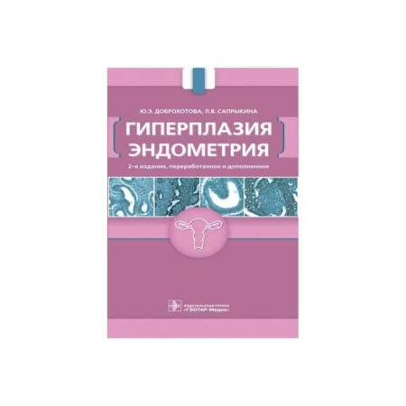 Hyperplasia of endometrium. Dobrokhotova Yu.