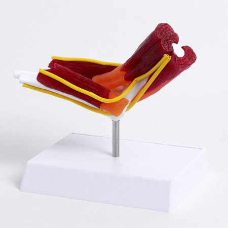 The layout "elbow joint with muscle tissue and ligaments" 21cm-1
