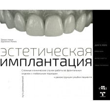 Эстетическая имплантация. Сложные клинические случаи работы во фронтальных отделах с глобальным подходом к реконструкции улыбки пациента. Лопс Д., Абас И., Гизотти М., Пиччиокки Г.