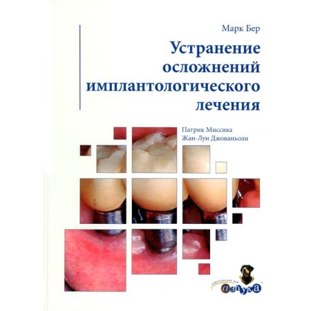 Elimination of complications of implantic treatment. Giovanioli J.-L., Ber M., Mission P.