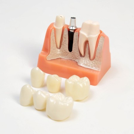 Mett "tooth structure" 9*6*9cm-1