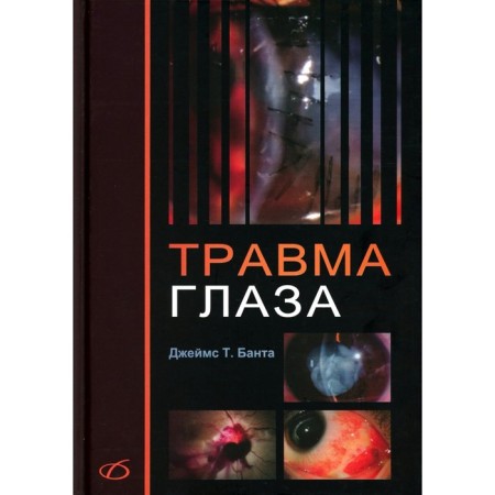 Травма глаза. Банта Дж.Т.