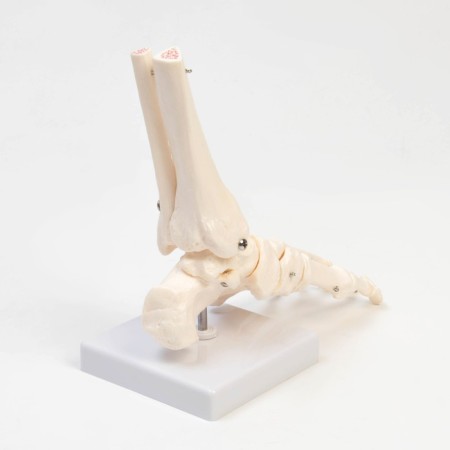 The Ikolnostopic joint layout is 25*11*11cm-2