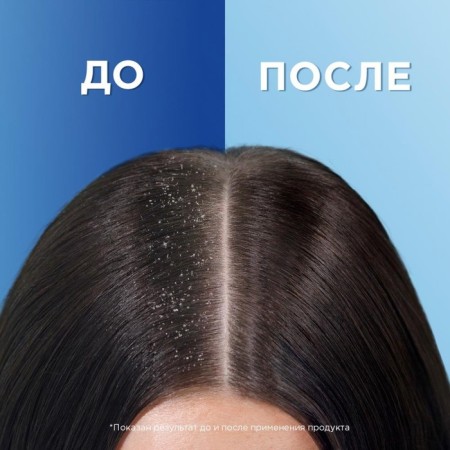 HEAD & ShOULDERS Fresh Fresh Fresh Shampoo, 400 ml-3