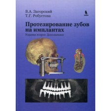 Протезирование зубов на имплантатах. 2-е издание, дополненное. Робустова Т.Г., Загорский В.А.
