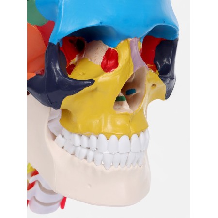 Matcage "Skull with the brain" Disassembly 27*19*12cm-5