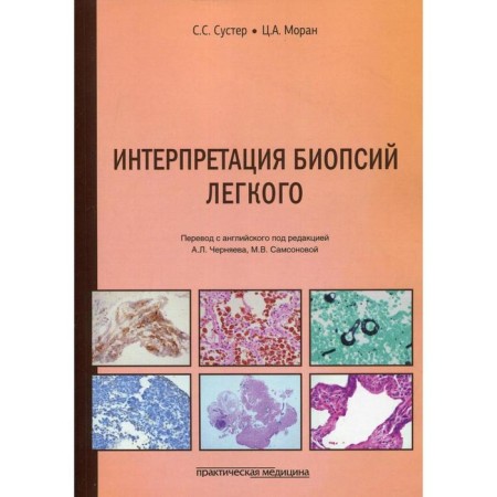 Interpretation of lung biopsy. Suster S. S., Moran Ts. A.