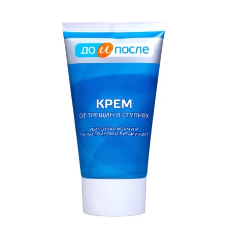 Foot cream "to and after" from cracks in the feet, 2 pcs 150 ml-1