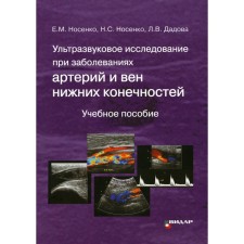 Ультразвуковое исследование при заболеваниях артерий и вен нижних конечностей. Учебное пособие. Носенко Е.М., Носенко Н.С., Дадова Л.В.