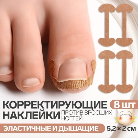 Set of stickers for correcting ingrown nails, 8 pcs, 5.2 × 2 cm, beige color