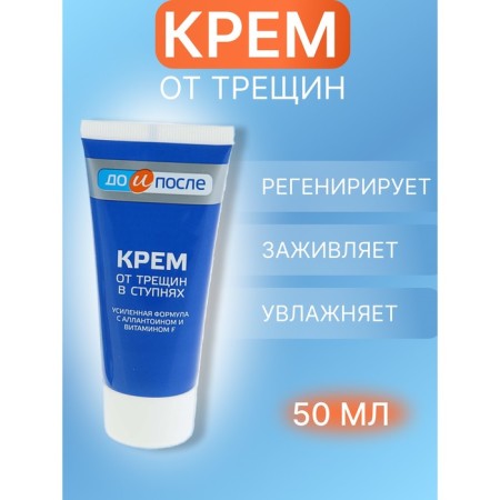 Legs cream from cracks in the feet, "before and after", 50 ml