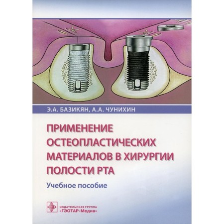 The use of osteoplastic materials in the oral cavity surgery. Bazikyan E.A., Chunikhin A.A.
