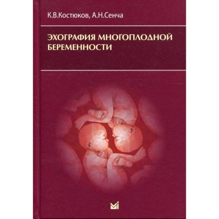 Echography of multiple pregnancy. Kostyukov K.V., Sencha A.N.