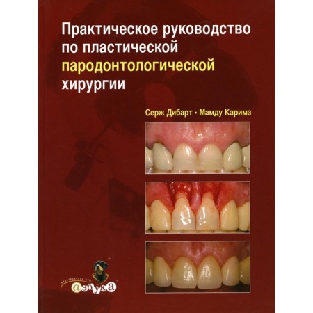 Practical guide to plastic paradontological surgery. Dibart S., Karima M.