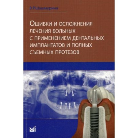 Errors and complications of treatment of patients using dental implants and complete removable prostheses. Shashmurina V.R.
