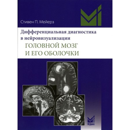 Differential diagnosis in neuroimaging. The brain and its shell. Meyers S.P.