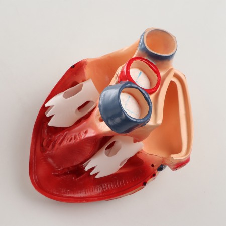 Matca "Human Heart" 26*18*22cm-4