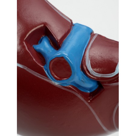 Matcage "liver in context"-4