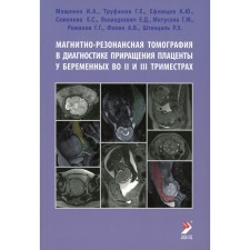 Magnetic resonance imaging in the diagnosis of placental increment in pregnant women in the II and III trimester. Mashchenko I.A., Trufanov G.E., Efimtsev A.Yu., Semenova E.S., Vyzidkevich E.D., Mitusova G.M. and others