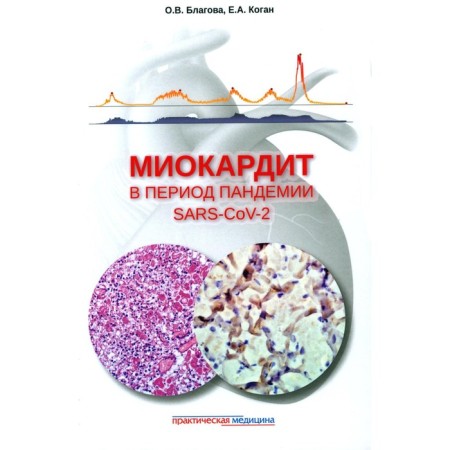 Myocarditis during the Pandemia SARS-COV-2. Blagova O.V., Kogan E.A.